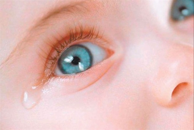ojos llororos en bebés