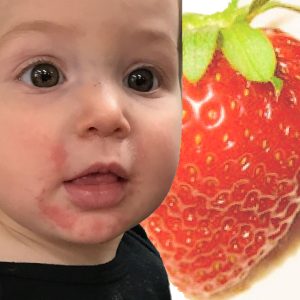 bebé con alergia a la fresa