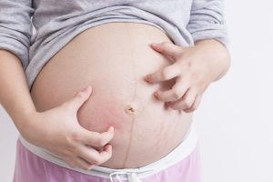 picazón en la barriga de la embarazada