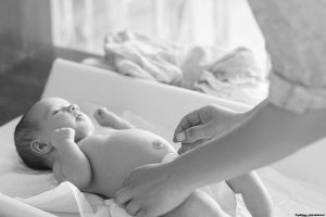 hernia umbilical en el bebé